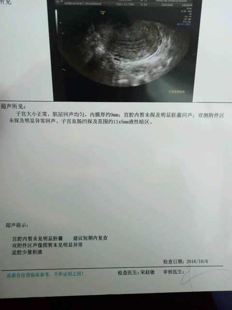 有没有40多天胚囊没有进子宫的MM_怀孕40天