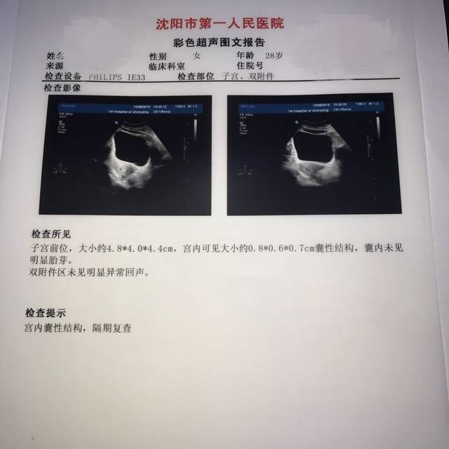 怀孕42天的b超单女生大伙帮看看_看这个值是一姐妹麻烦左一右头像图片