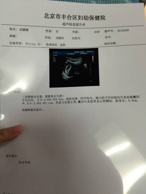 接健康的胎心胎芽啦!_43天去检查没有胎心胎芽