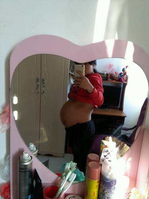 有没有准妈妈怀孕后期手肿的,而且发麻,连着胳