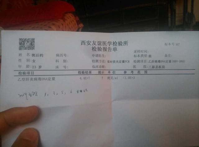 请教一下_乙型肝炎病毒定量4.4e+7 肝功能正常