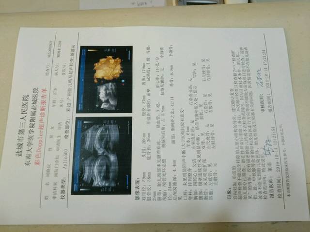 四维彩超_今天下午刚做完四维彩超,图片上面孩