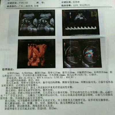 大家看一下,我现在23周了,今天做的四维,胎儿大小合适吗?_育儿问答_宝宝树