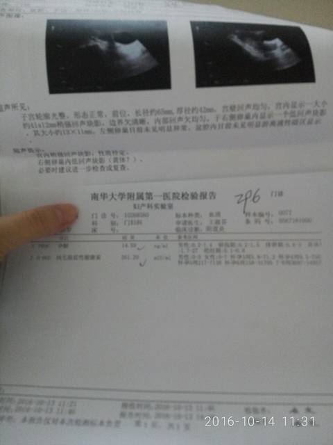 末次月经8.31,左腹一直疼痛,今天要离开6月圈了