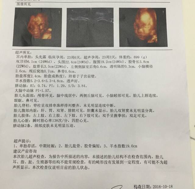 孕妈们,帮我看看四维彩超单子顺不顺利_今天2