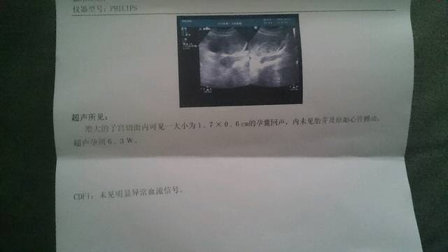 孕妈宝妈们帮看看这样还有希望吗?_早孕b超都