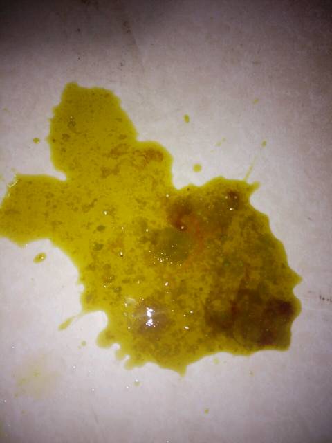 求助,有图慎入_宝宝三个月,前两天拉屎有血-图