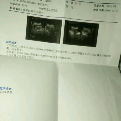 末次月经是8月24日,我月经都推迟半个月到一个