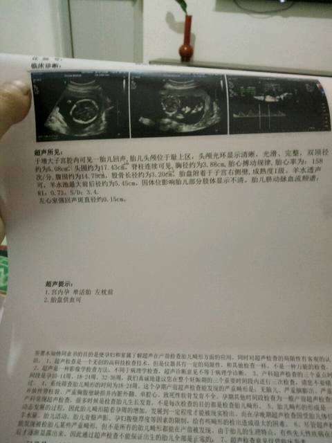 儿女双全,b超看男女真的准嗳