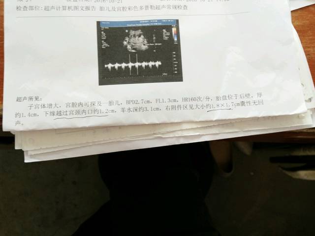 孕3个月_怀孕3个月的检查结婚,正常吗,知道医