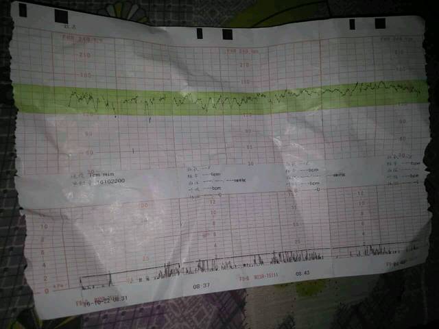 。孕27周胎动频繁,胎心监测平稳。怎么办_孕2