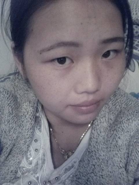 脸肿了_右耳朵好疼,这边脸都肿了,有谁知道有