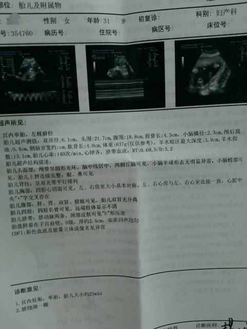 新鲜出炉四维B超单 来猜男女咯_孕24周 超快顺