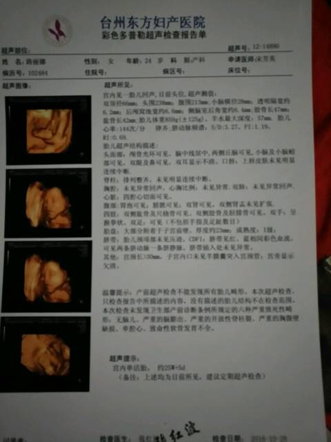 怀孕25周零5天今天做的四维彩超谁能看懂男女