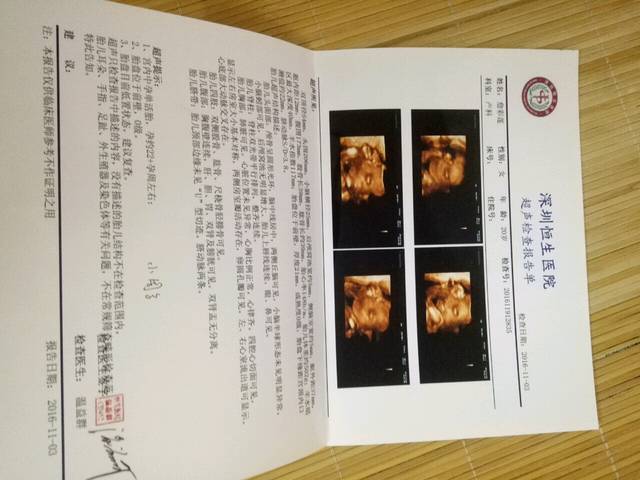 来接正能量四维彩超通过_四维彩超通过,宝宝很