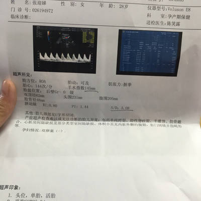 孕妇25 3,sd值高,怎么办?都是什么原因导致的,有没好的办法物理处理?