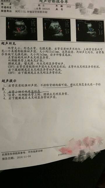 孕期发现肾错构瘤,压力山大_今日孕检,B超上显