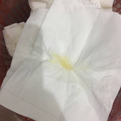 孕40整了,刚洗澡下面流出跟鼻涕似的的东西,下面我有附图,求有经验的