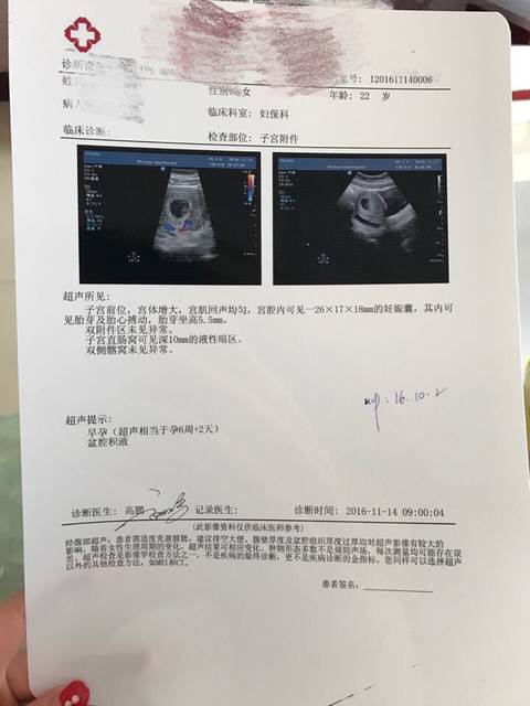 怀孕6周加2,b超显示盆腔积液,_之前检查有宫颈