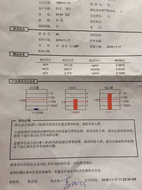 唐筛高危_昨天做唐筛18三体和ontd都是高风险