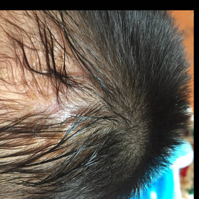 今天帮宝宝剪短头发后发现宝宝头上左边有个软