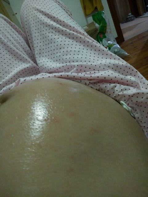 肚子上红点点,是妊娠纹吗?_我从28周开始肚子