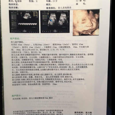 孕26周做四维彩超,胎儿小脑延髓池宽10mm正