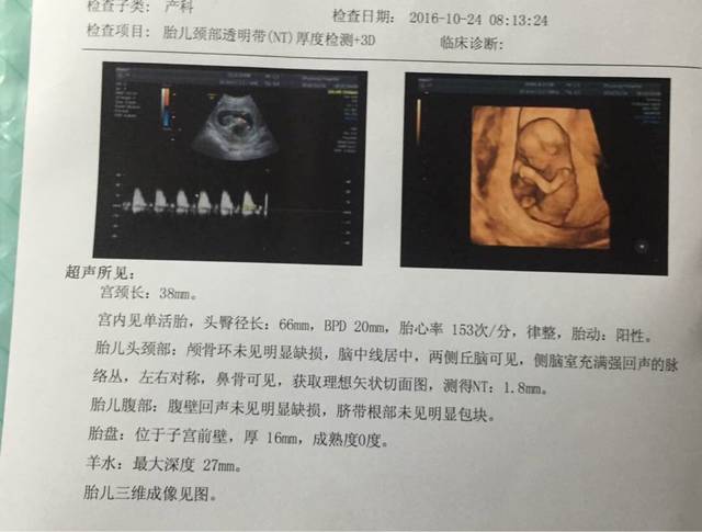 三个半月,昨天检查是女宝_怀孕症状,40多天胎