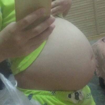 怀孕没有妊娠线是男孩