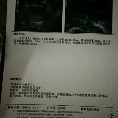 今天试管移植四十五天二超,胎芽21mm,有胎心