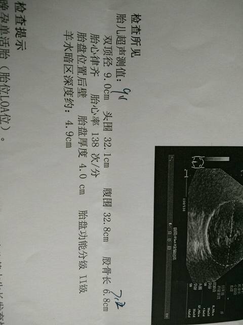 37周B超数据标准是多少_37+2天,这是今天刚做