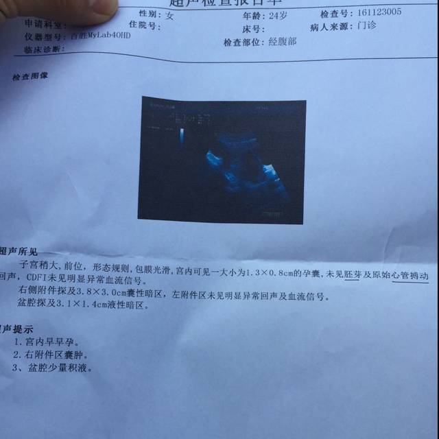大家帮我看一下怀孕52天没有手机和心管v手机拉胚芽的看电影女生图片