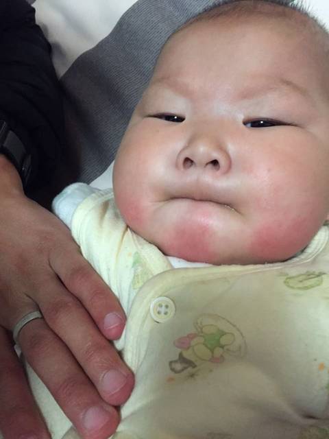 宝宝脸颊,下颚有红块。_这两天陆陆续续长的,