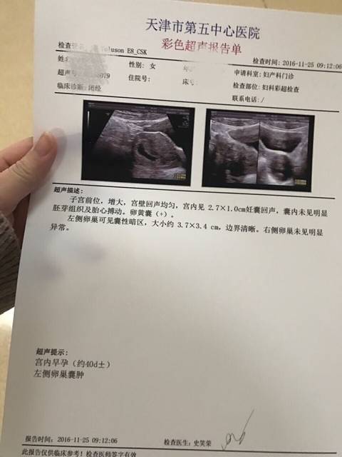 有看懂b超单上说的早孕天数的孕妈吗?能否给