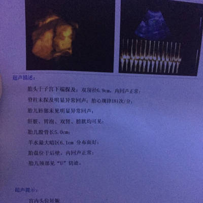 今天怀孕26周了,去做了四维彩超,检查一切都好