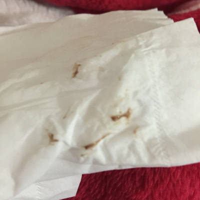 怀孕初期 你们有这种褐色分泌物吗 就偶尔有一