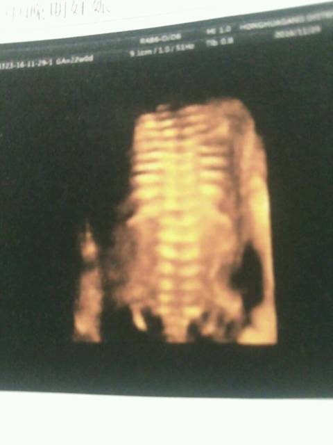 怀孕22周_我今天照四维彩超回来,大家分析一下