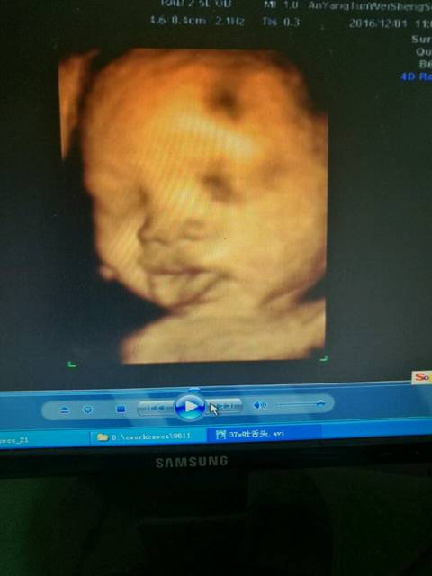 胎宝宝在肚里吐舌头了,好可爱啊_做四维看到宝