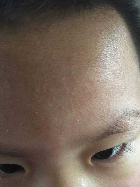 求助大神宝宝脸上长得是什么?_儿子自从添加