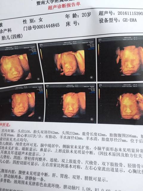 帮忙看男孩_四维归来有没有看女生男女的v男孩女孩的打图片