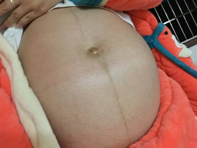 怀孕7个月肚子变了_宝爸说梦见我去医院生孩