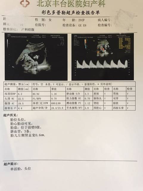 24周排畸B超,宝宝问题大不?
