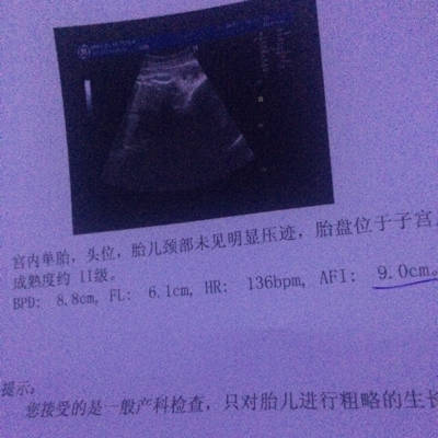 怀孕八个月做彩超,医生说小孩头偏大,有点担心,想问问