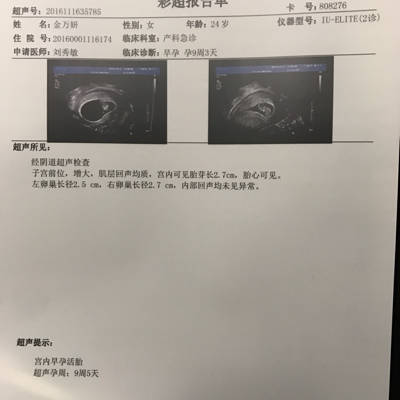医生您好,从现在的b超单上可以看出宝宝健康么?孕囊可以看出男孩女孩么