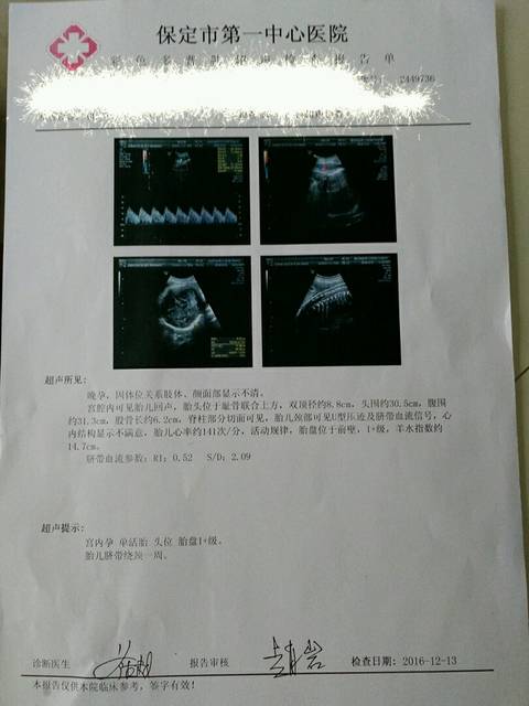 孕34周+4,胎儿股骨长6.2,马玉洁说胎儿小_昨天
