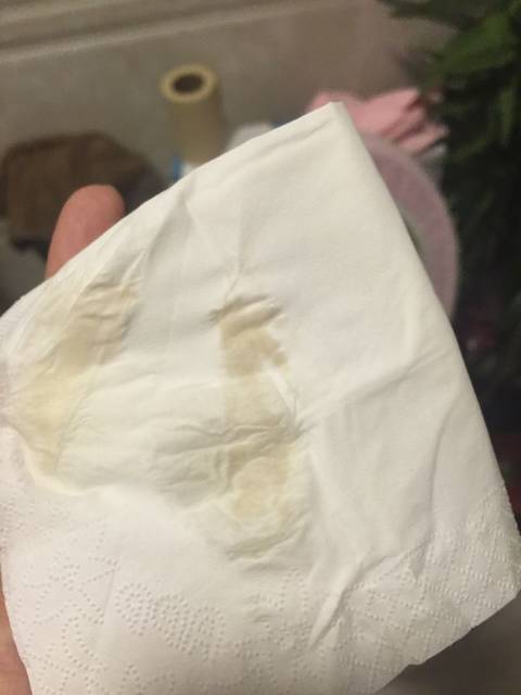 怀孕5周,每天都流褐色分泌物,该怎么办_大家帮