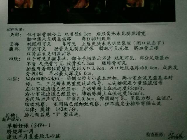 24周四维女生_看出来女孩图片的?男孩高清可爱图片彩超图片