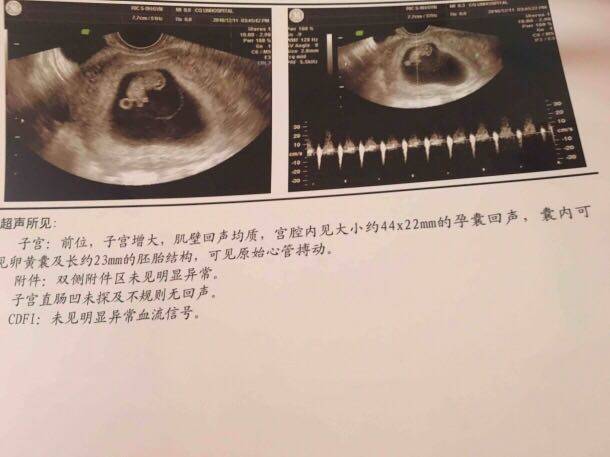 帮忙看看是男宝还是女宝_怀孕9周,大家帮忙看看是男宝,还是女_宝宝树