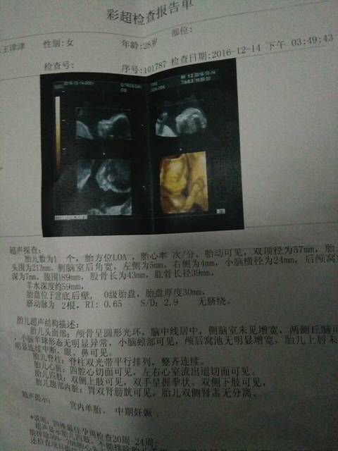 菲菲妈咪_四维男孩通过了看图片发型彩超女生女孩中发2015图片