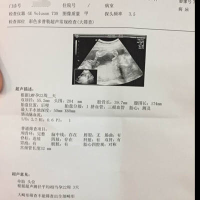 结果里显示有宫颈管长度 说明是女宝宝吗?请帮忙看看.